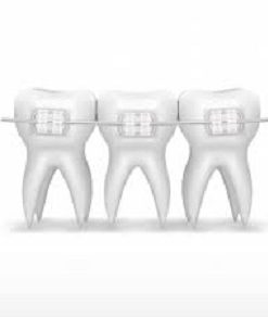 Ορθοδοντικά